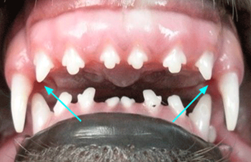 Overbites and underbites